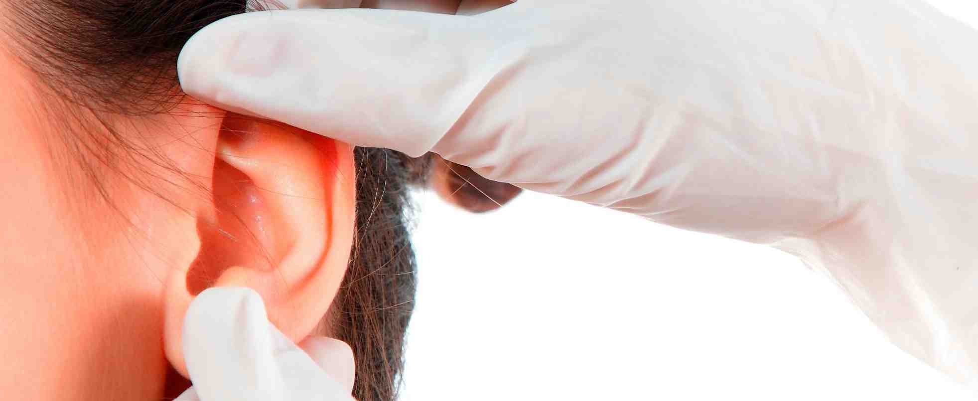 Отопластика – пластическая операция на ушной раковине